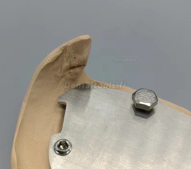 Enregistreur vertical de relation centr&eacute;e avec traceur gothique pour patients &eacute;dent&eacute;s